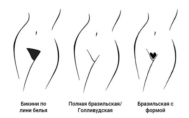 Лазерная эпиляция бикини в Минске